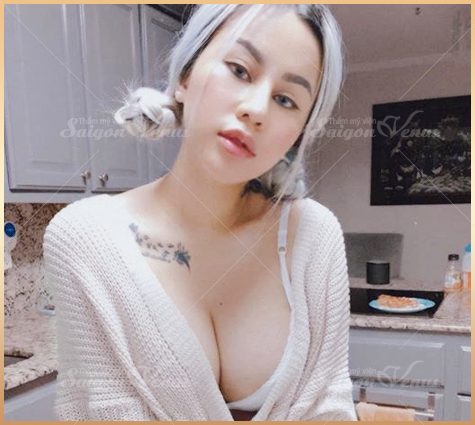 thẩm mỹ sài gòn venus