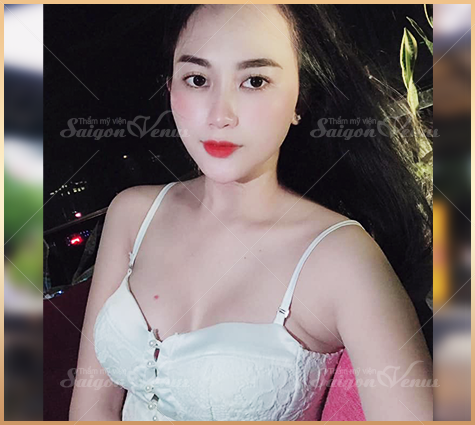 thẩm mỹ sài gòn venus