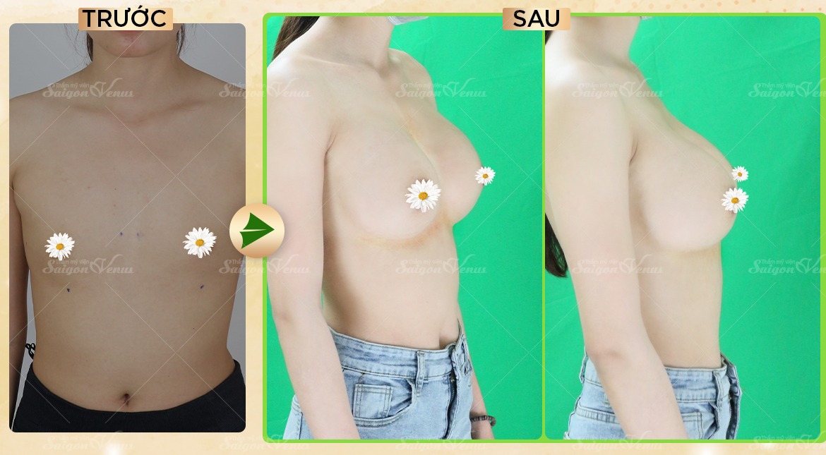 thẩm mỹ sài gòn venus