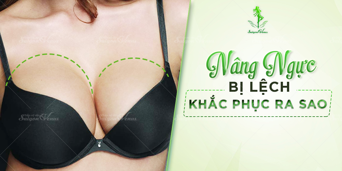 Ngực sau khi nâng bị lệch phải làm sao?