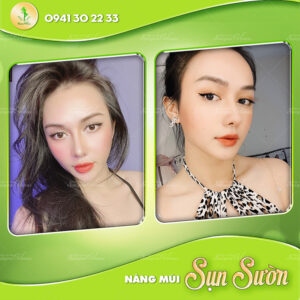 TỔNG HỢP DÁNG MŨI “HOT TREND” NHẤT THỊ TRƯỜNG ĐƯỢC CÁC HOT TIKTOKER ƯU ÁI, CHỌN LỰA?