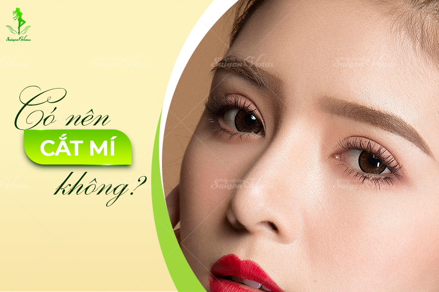 CÓ NÊN ĐI CẮT MẮT KHÔNG?