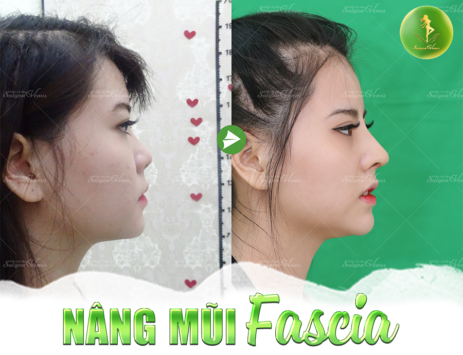 TIN TƯỞNG VÀO PHẪU THUẬT THẨM MỸ, NÊN HAY KHÔNG NÊN?