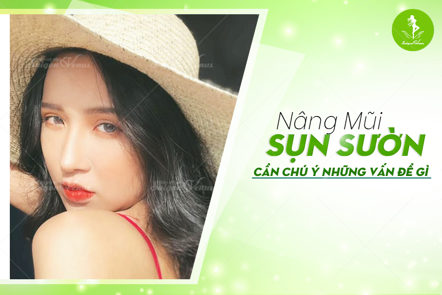 NÂNG MŨI SỤN SƯỜN CẦN CHÚ Ý NHỮNG VẤN ĐỀ GÌ