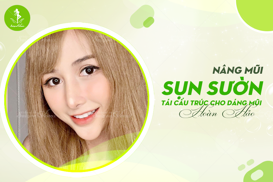 NÂNG MŨI SỤN SƯỜN – TÁI CẤU TRÚC DÁNG MŨI HOÀN HẢO