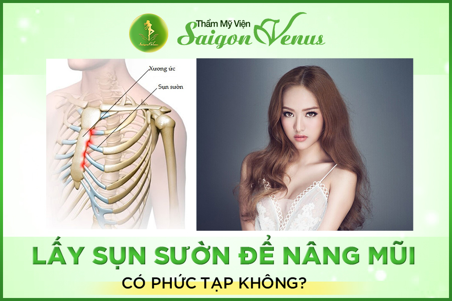 LẤY SỤN SƯỜN NÂNG MŨI CÓ PHỨC TẠP KHÔNG?