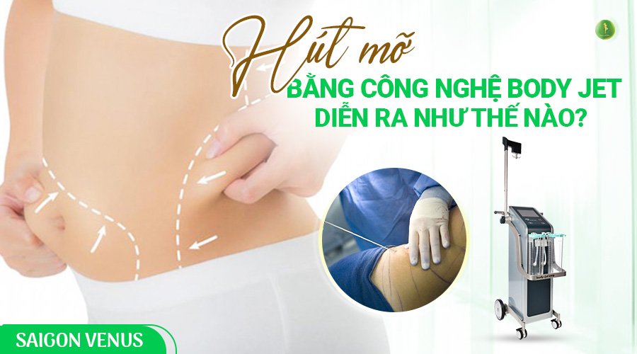HÚT MỠ CÔNG NGHỆ BODY JET EVO