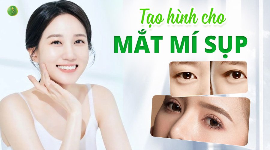 TẠO HÌNH CHO MÍ MẮT BỊ SỤP