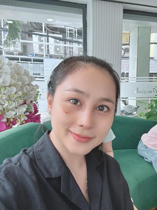 vivian-nguyen-tu-tin-xinh-dep-sau-6-thang-nang-mui-sun-suon-voi-bam-mi-0