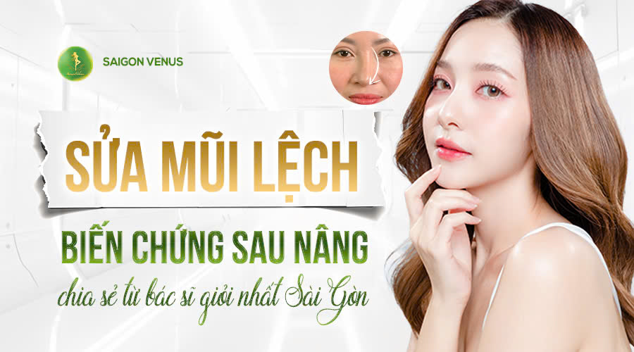 Sửa Mũi Lệch – Biến Chứng Sau Nâng Và Giải Pháp An Toàn Từ Bác Sĩ Huy Sửa Mũi Hỏng Giỏi Nhất TP.HCM