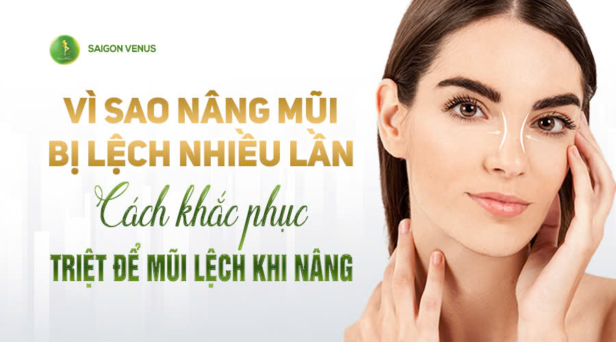 Vì sao nâng mũi bị lệch nhiều lần? Giải pháp khắc phục triệt để tại SaiGon Venus
