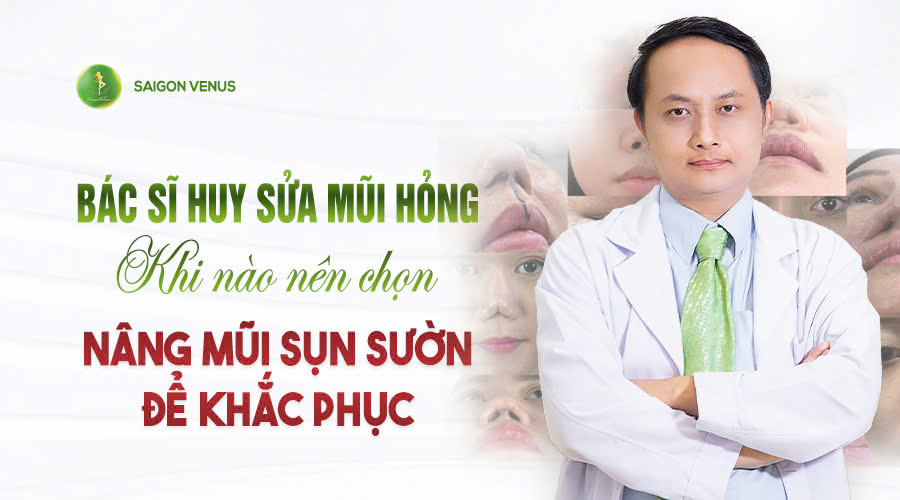 Bác sĩ Huy sửa mũi hỏng – Khi nào nên chọn nâng mũi sụn sườn để khắc phục?