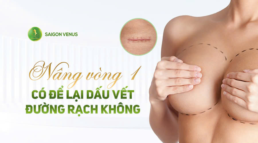 NÂNG V1 CÓ ĐỂ LẠI DẤU VẾT SẸO HAY KHÔNG?