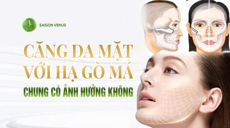 CĂNG DA MẶT VỚI HẠ GÒ MÁ CHUNG CÓ ẢNH HƯỞNG KHÔNG